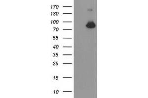 Western Blotting (WB) image for anti-Acyl-CoA Synthetase Short-Chain Family Member 2 (ACSS2) antibody (ABIN1496429) (ACSS2 anticorps)