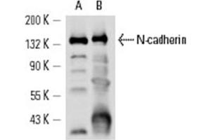 Image no. 1 for anti-Cadherin 2 (CDH2) antibody (ABIN272296) (N-Cadherin anticorps)