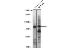 Western blot analysis of extracts of various cell lines, using PADI2 antibody (ABIN4904665) at 1:1000 dilution. (PADI2 anticorps)