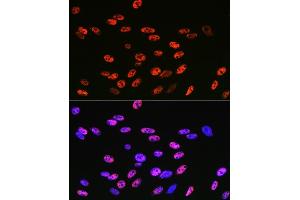 Immunofluorescence analysis of C6 cells using KLF4 Rabbit mAb (ABIN7268157) at dilution of 1:100 (40x lens).