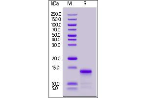 Biotinylated Human IL-8, His,Avitag on  under reducing (R) condition.
