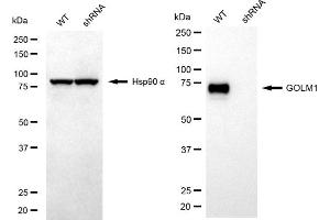Western blotting analysis using GOLM1 antibody (ABIN7798793). (GOLM1 anticorps)