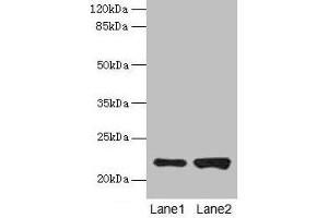 Western blot All lanes: CDC42 antibody at 6 μg/mL Lane 1: Hela whole cell lysate Lane 2: Jurkat whole cell lysate Secondary Goat polyclonal to rabbit IgG at 1/10000 dilution Predicted band size: 22 kDa Observed band size: 22 kDa (CDC42 anticorps  (AA 2-188))