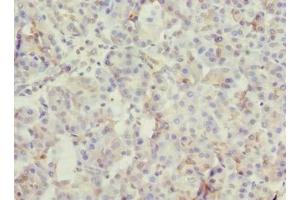 anti-Rogdi Homolog (ROGDI) (AA 14-287) antibody