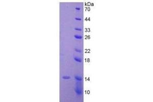 SDS-PAGE analysis of Human AMH Protein. (AMH Protéine)