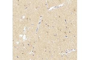 IHC analysis of UBE3A using anti-UBE3A antibody (ABIN7599562). (ube3a anticorps  (AA 1-860))