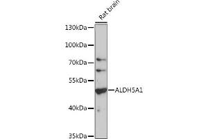 Western blot analysis of extracts of rat brain, using  antibody (6074) at 1:1000 dilution. (ALDH5A1 anticorps  (AA 400-500))