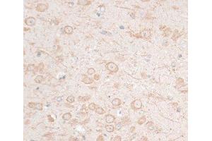 Immunohistochemistry of paraffin-embedded Mouse brain using HMGA1 Polyclonal Antibody at dilution of 1:100 (40x lens). (HMGA1 anticorps)