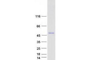 Validation with Western Blot