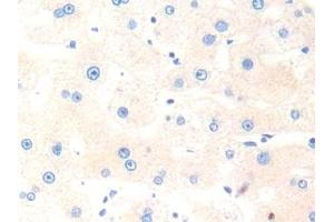 Detection of CTSK in Human Liver Tissue using Polyclonal Antibody to Cathepsin K (CTSK)