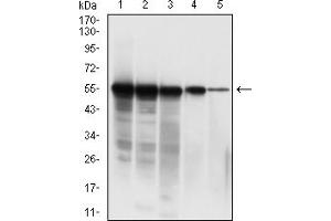 Western blot analysis using SARS-CoV-2-NP3 mAb against human SARS-CoV-2-N (AA: 1-419) recombinant protein. (SARS-CoV-2-NP3 (AA 240-419) anticorps)