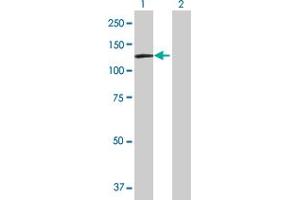 Lane 1: DDX11 transfected lysate ( 106.