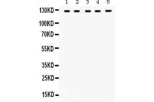 Anti- TRPM8 Picoband antibody, Western blottingAll lanes: Anti TRPM8  at 0. (TRPM8 anticorps  (C-Term))