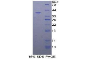 Rabbit Detection antibody from the kit in WB with Positive Control: Human hela cells.