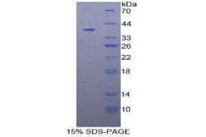 Rabbit Detection antibody from the kit in WB with Positive Control: Human hela cells. (SFRP4 Kit ELISA)