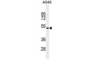 Western Blotting (WB) image for anti-Transforming Growth Factor, beta 2 (TGFB2) antibody (ABIN2995350) (TGFB2 anticorps)