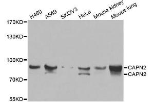 Western blot analysis of extracts of various cell lines, using CAPN2 antibody. (Calpain 2 anticorps)