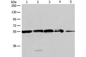 Western Blot analysis of A375, 293T cell and Mouse liver tissue, Jurkat cell and Human fetal kidney tissue using NAMPT Polyclonal Antibody at dilution of 1:700 (NAMPT anticorps)