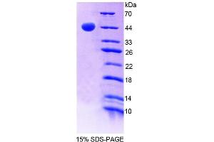 SDS-PAGE analysis of Human GHRHR Protein. (GHRHR Protéine)
