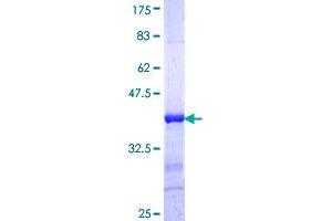 Image no. 1 for Progesterone Immunomodulatory Binding Factor 1 (PIBF1) (AA 660-755) protein (GST tag) (ABIN1314999)