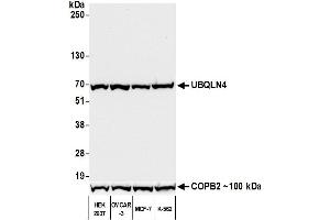Western Blotting (WB) image for anti-Ubiquilin 4 (UBQLN4) (AA 2-601) antibody (ABIN7453990) (Recombinant UBQLN4 anticorps  (AA 2-601))