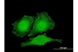 Immunofluorescence of monoclonal antibody to ZYX on HeLa cell. (ZYX anticorps  (AA 1-572))