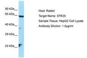 Image no. 1 for anti-Serine/threonine Kinase 35 (STK35) (AA 106-155) antibody (ABIN6750141)