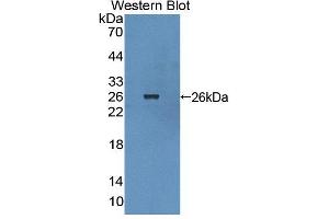Figure. (BCR anticorps  (AA 1042-1243))