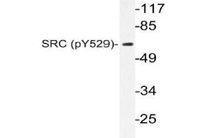 Western blot (WB) analysis of p-c-RAF antibody in extracts from K562 cells. (NCOA1 anticorps  (pTyr529))