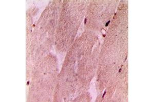 Immunohistochemical analysis of RPL3L staining in human muscle formalin fixed paraffin embedded tissue section.