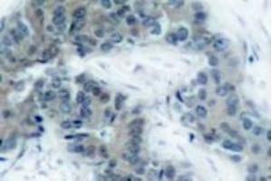 Image no. 1 for anti-Janus Kinase 2 (JAK2) (pTyr1007) antibody (ABIN318056) (JAK2 anticorps  (pTyr1007))