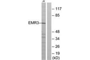 Western blot analysis of extracts from Jurkat cells, using EMR3 Antibody. (EMR3 anticorps  (AA 603-652))