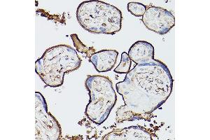 Immunohistochemistry of paraffin-embedded human lung using THBD Rabbit pAb (ABIN1683026, ABIN3018621, ABIN3018622 and ABIN6220518) at dilution of 1:25 (40x lens).