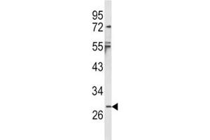 Western blot analysis of IL-1B antibody and NCI-H460 lysate.