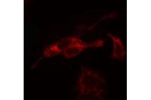 ABIN6266835 staining Hela cells by IF/ICC. (ADPGK anticorps  (Internal Region))