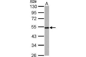 WB Image Cyclin A2 antibody detects CCNA2 protein by Western blot analysis.