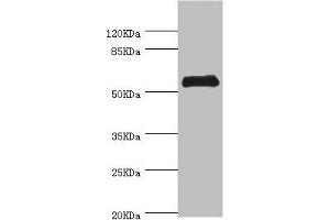 Western blot All lanes: CHIA antibody at 0.