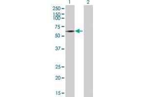 Western Blot analysis of SEMA3B expression in transfected 293T cell line by SEMA3B MaxPab polyclonal antibody.