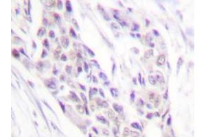 Image no. 1 for anti-Cyclin A1 (CCNA1) antibody (ABIN265378) (Cyclin A1 anticorps)
