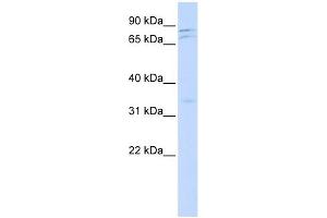 NEK11 antibody used at 1 ug/ml to detect target protein. (NEK11 anticorps)