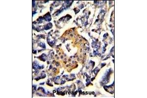 Formalin-fixed and paraffin-embedded human pancreas with SRP72 Antibody (Center), which was peroxidase-conjugated to the secondary antibody, followed by DAB staining.