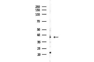 anti-Carbohydrate (Chondroitin 4) Sulfotransferase 13 (CHST13) (Internal Region) antibody