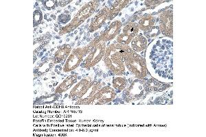 Rabbit Anti-CDH8 Antibody  Paraffin Embedded Tissue: Human Kidney Cellular Data: Epithelial cells of renal tubule Antibody Concentration: 4.