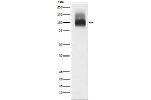 Western blot analysis of Band 3 / CD233 expression in Red blood cell lysate.
