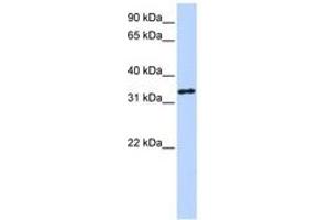 Image no. 1 for anti-3-hydroxyanthranilate 3,4-Dioxygenase (HAAO) (AA 72-121) antibody (ABIN6740761) (HAAO anticorps  (AA 72-121))