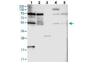 Western blot analysis of Lane 1: RT-4, Lane 2: U-251 MG, Lane 3: Human Plasma, Lane 4: Liver, Lane 5: Tonsil with TOX4 polyclonal antibody  at 1:250-1:500 dilution. (TOX4 anticorps)