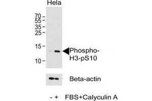 Western blot analysis of lysate from HeLa cell line using phospho-Histone H3 antibody at 1:1000.