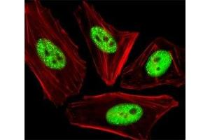 Fluorescent image of HeLa cells stained with phospho-CDC25A antibody at 1:25 dilution. (CDC25A anticorps  (pThr507))