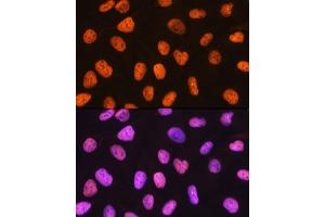 Immunofluorescence analysis of U-2 OS cells using PTBP1 Rabbit mAb (ABIN7269464) at dilution of 1:100 (40x lens).