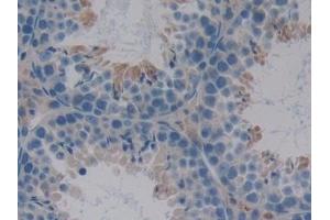 Detection of SERPINA10 in Mouse Testis Tissue using Polyclonal Antibody to Serpin A10 (SERPINA10)